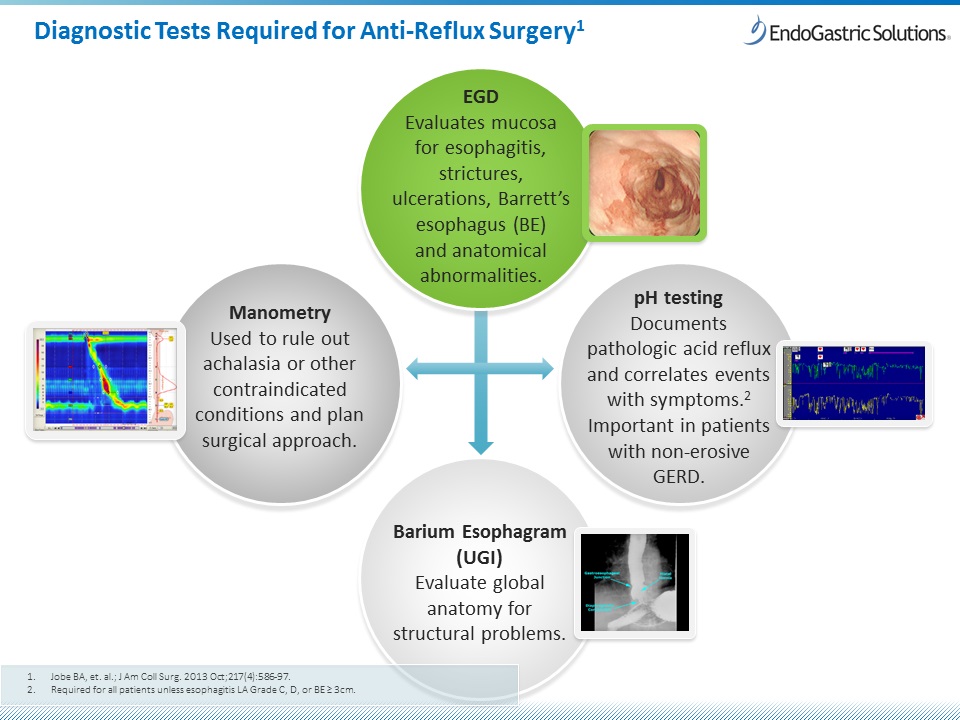 Diagnosis of GERD tests