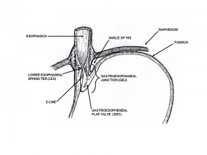 Distal esophageal and gastroesophageal anatomy Distal esophageal and gastroesophageal anatomy