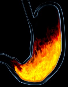 GERD symptoms, heartburn,