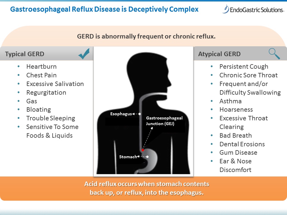 Typical Atypical GERD Symptoms