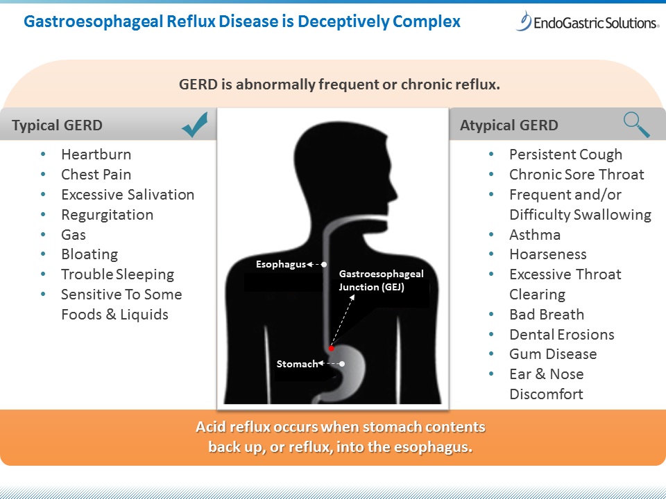 Acid reflux burning ears throat